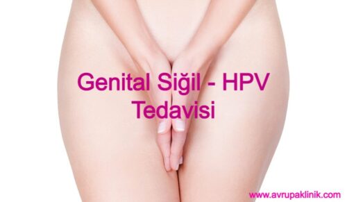 Istanbul Genital sigil tedavisi fiyati hpv kondilom tedavisi fiyatlari bikini bolgesi sigil tedavisi 500x291 - Genital Siğil - HPV